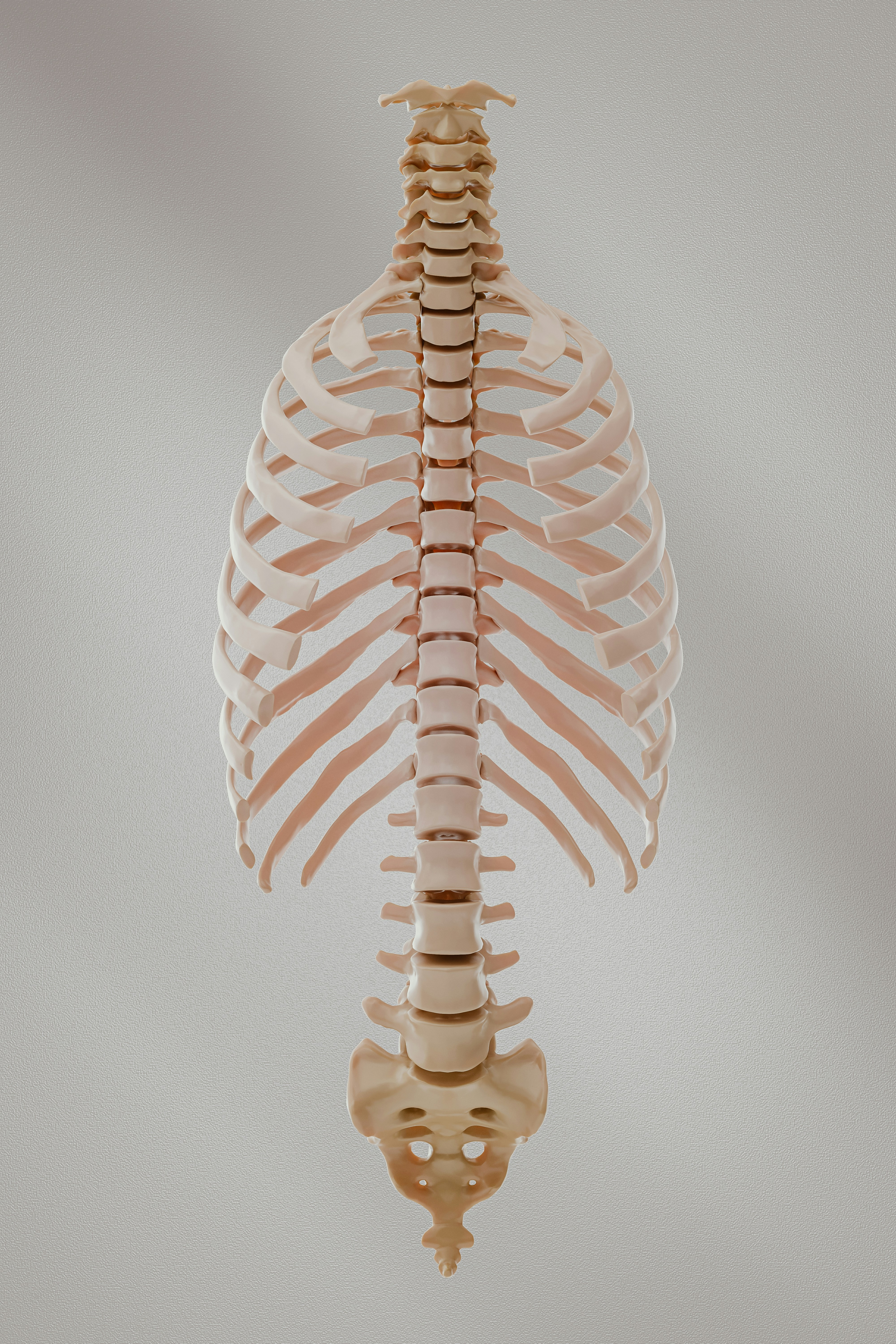 Anatomical diagram illustrating a lumbar disc herniation and its effect on the sciatic nerve.