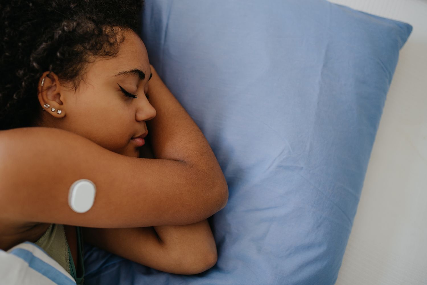 A person wearing a continuous glucose monitor (CGM) patch on their upper arm.