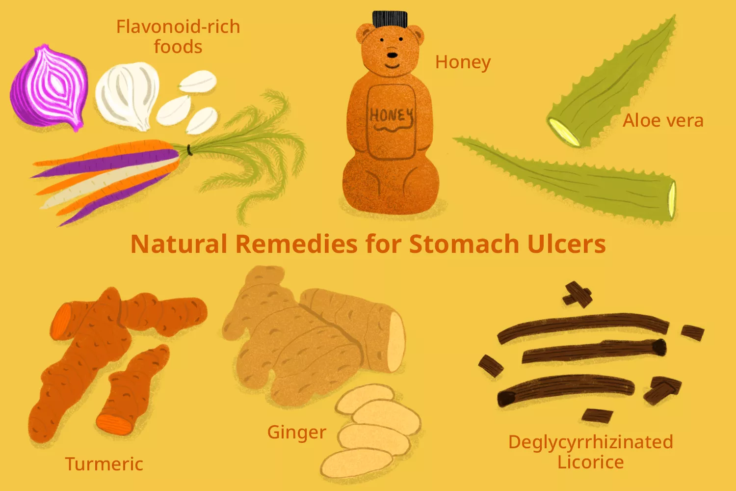 An medical-style illustration displaying various natural stomach ulcer remedies such as honey and anti-inflammatory foods.