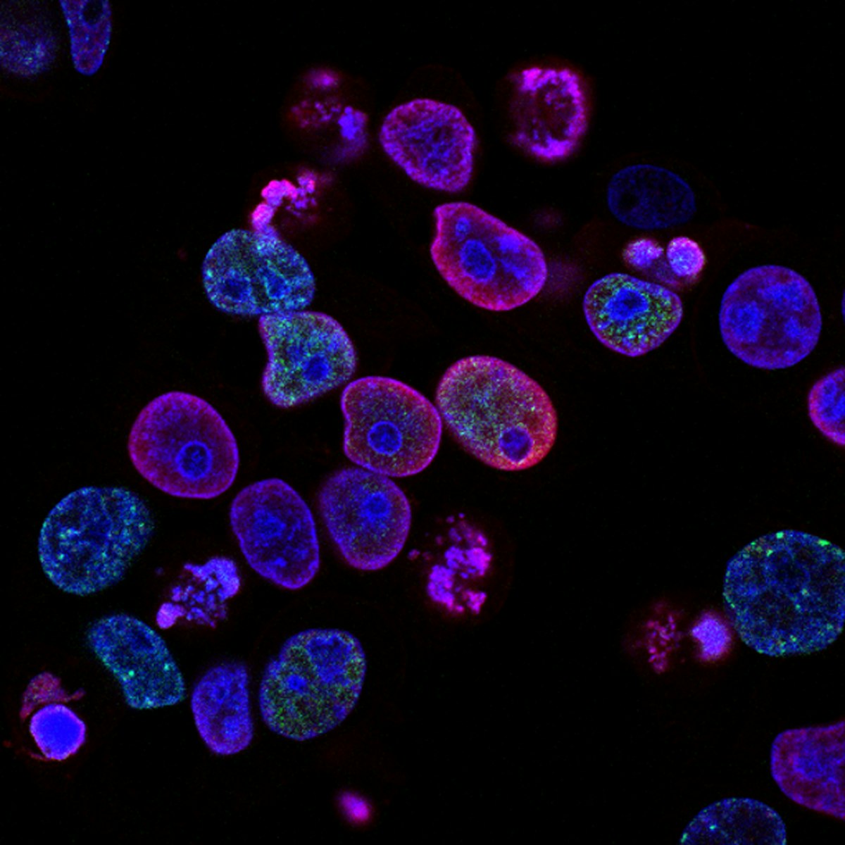A scientist working with advanced medical equipment in a research laboratory.
