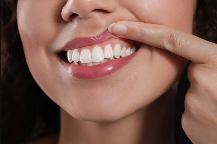 Close-up of effective dental plaque control and preventative hygiene