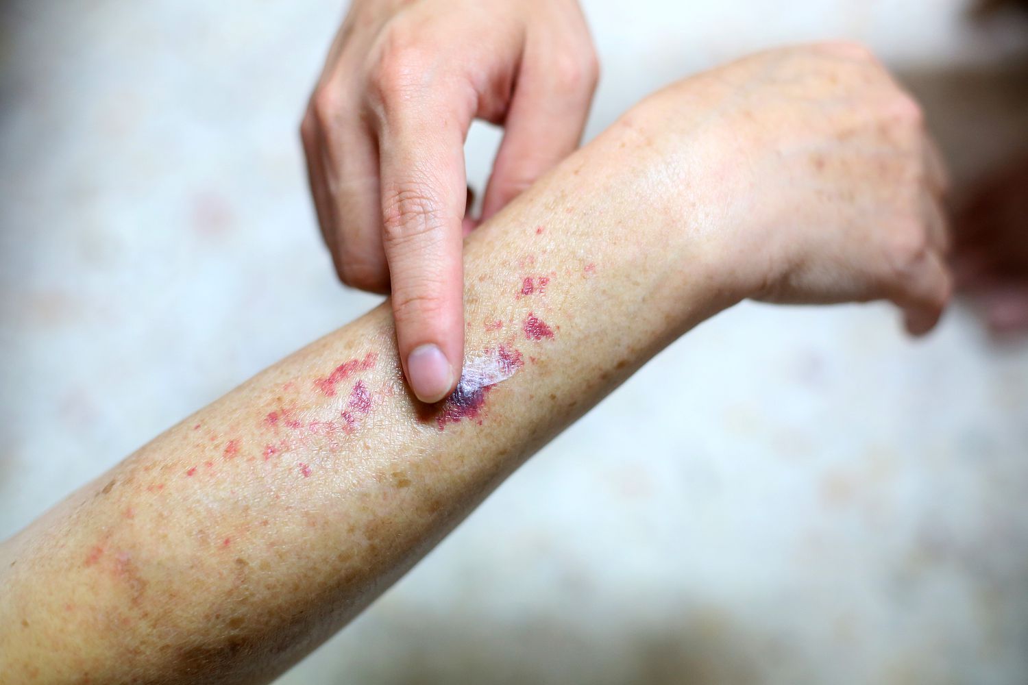A clinical or wellness-themed stock photo from Getty Images representing health and supplementation.