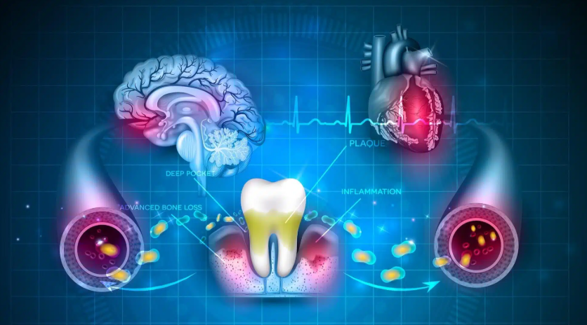 Diagram showing the inflammatory effects of periodontal disease