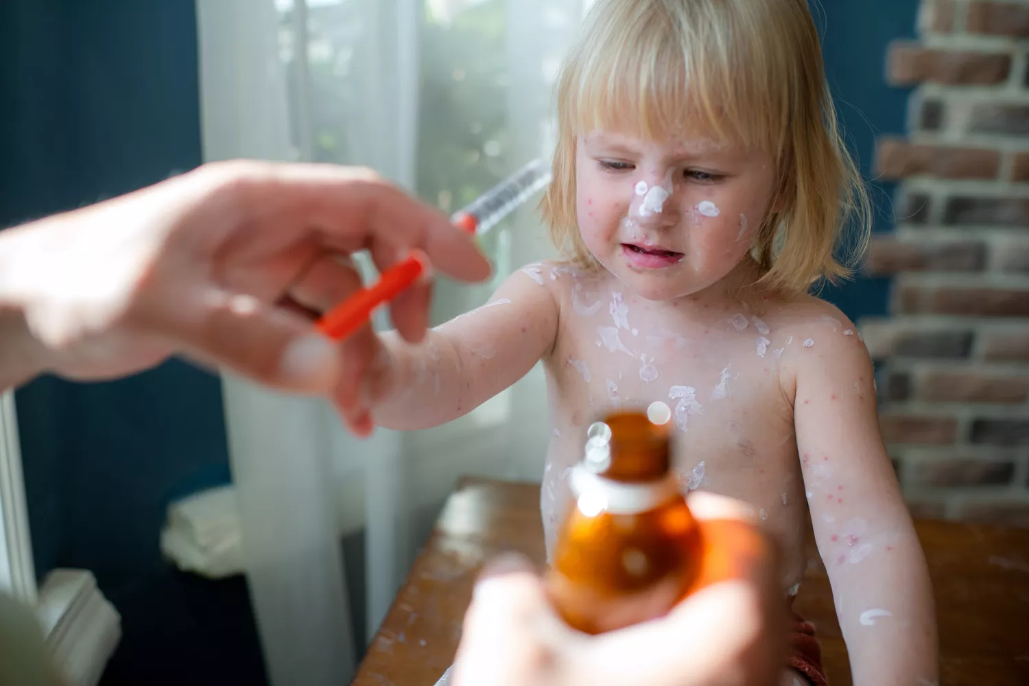 A young toddler receiving soothing care for a viral rash on their skin.