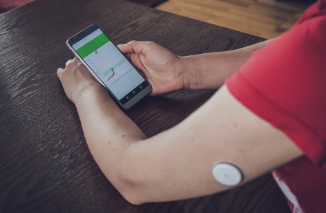 The compact Dexcom G7 wearable sensor applied to a user's arm for metabolic tracking.