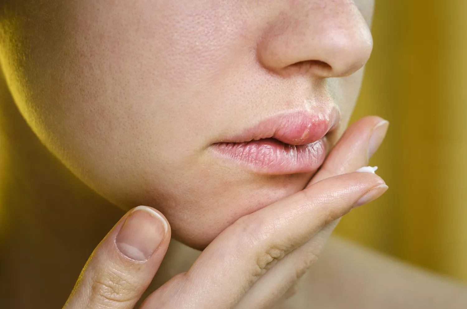 A close-up of someone carefully applying a topical treatment to their lips.