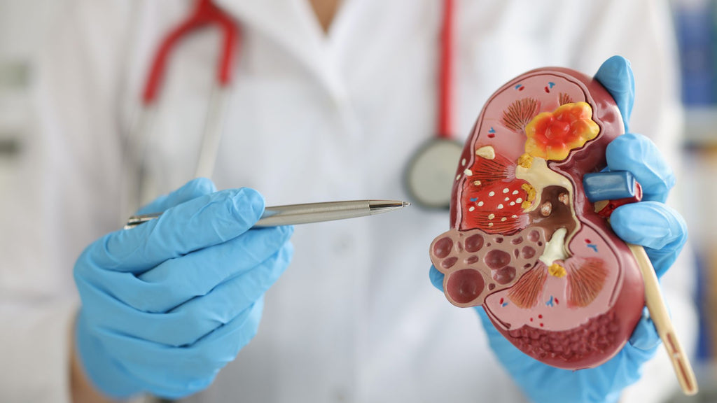 An illustration showing waste products like urea accumulating in the bloodstream due to kidney failure.