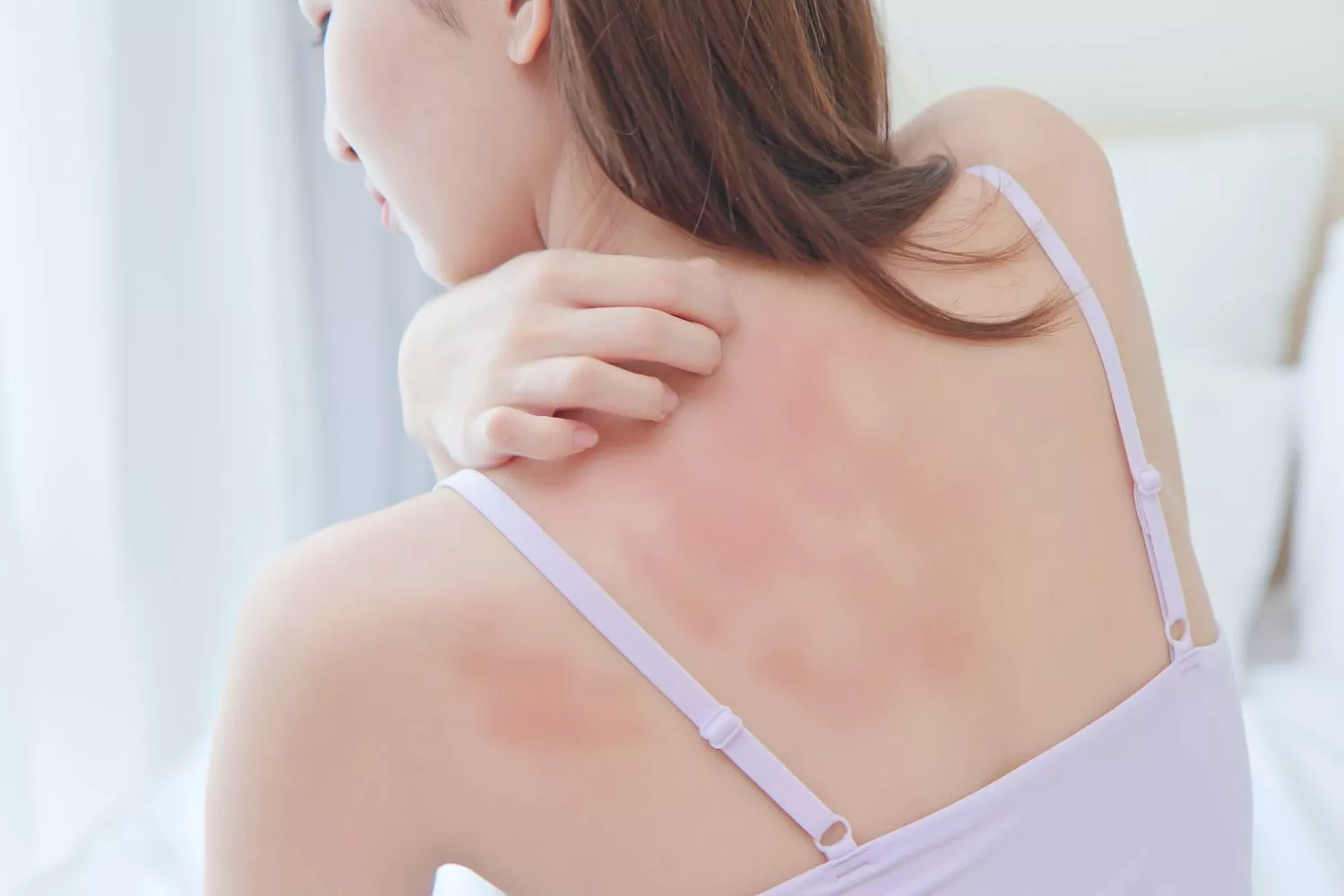 A woman reaching back to scratch her skin, representing the discomfort of a rash.