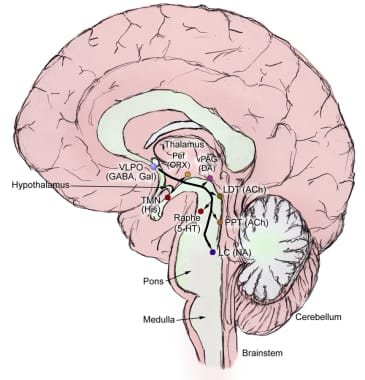 Anatomical diagram of the brain's ventrolateral pre-optic nucleus (VLPO) and its inhibitory projections.