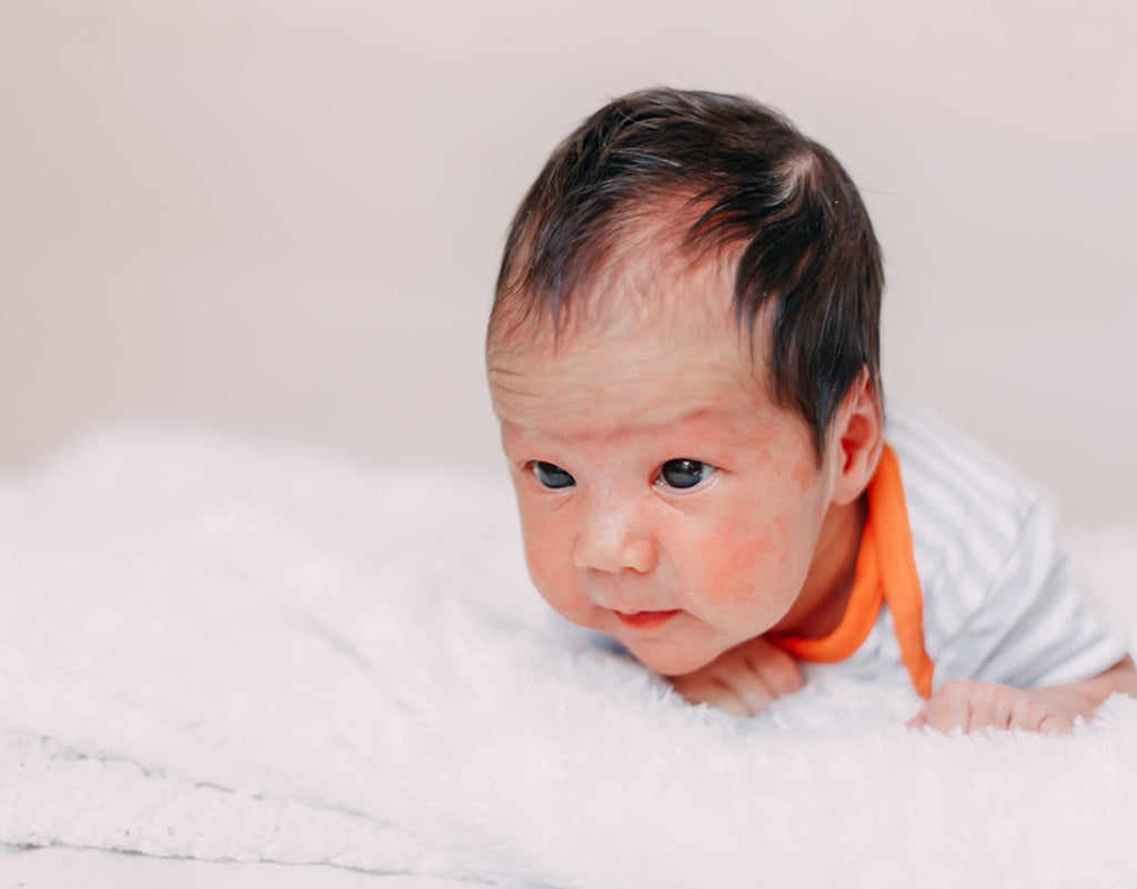 A composite view of different baby skin conditions including red patches and scales characteristic of eczema and heat rash.