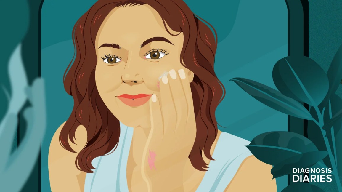 My Journey to a Clear Psoriasis Diagnosis